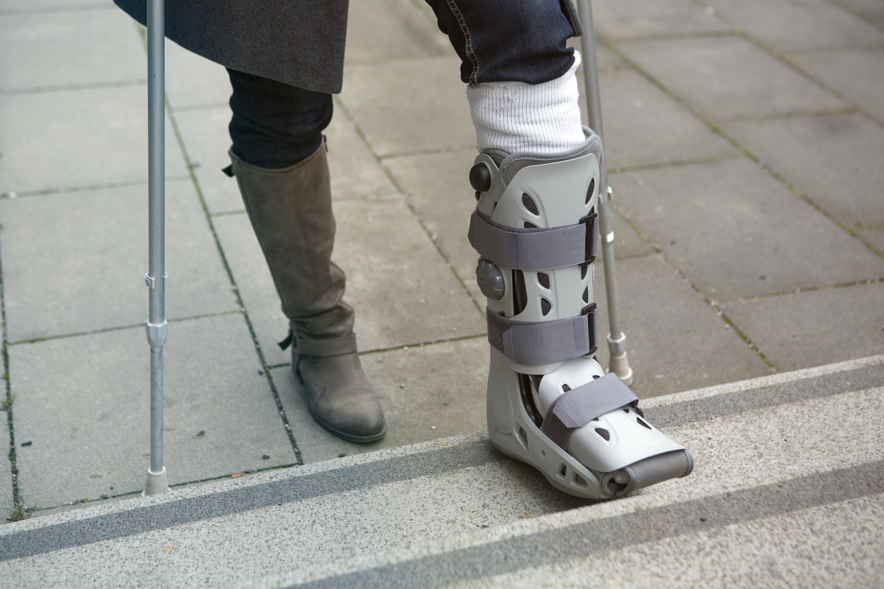 Woman with cast on foot and ankle.